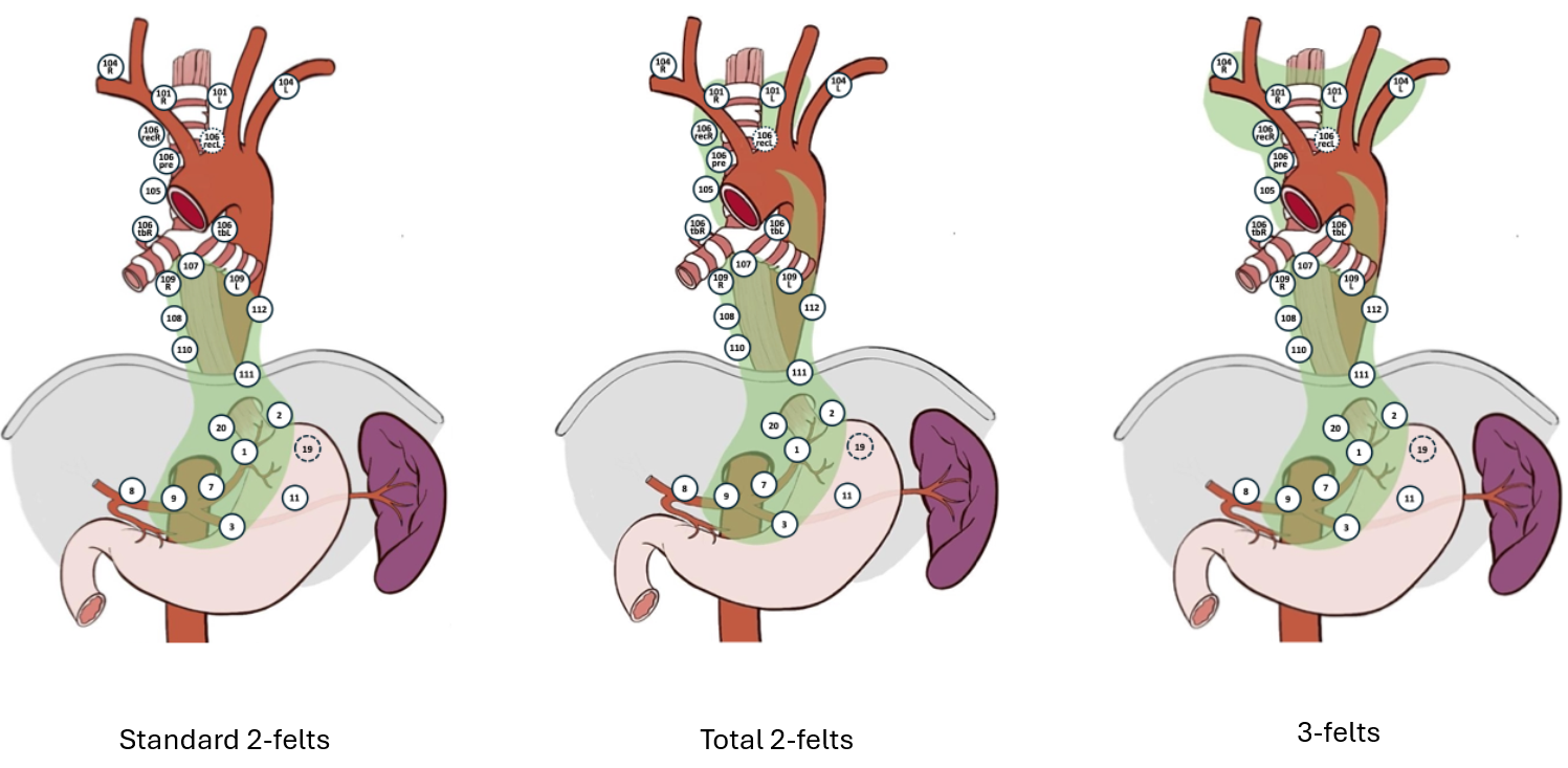 Figur 7: Lymp node dissection in transthoracic esophagectomy for esophageal cancer. Gjengitt fra  Matsunda et al. (Matsuda et al., 2017). CC-BY-4.0. Open access.