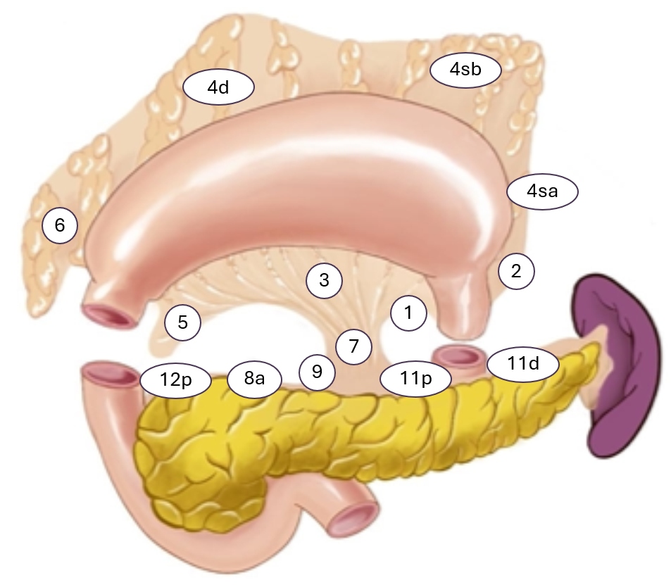 Figur 8: Hentet fra Japanese Gastric Cancer Association (2023). CC BY 4.0. Open access.