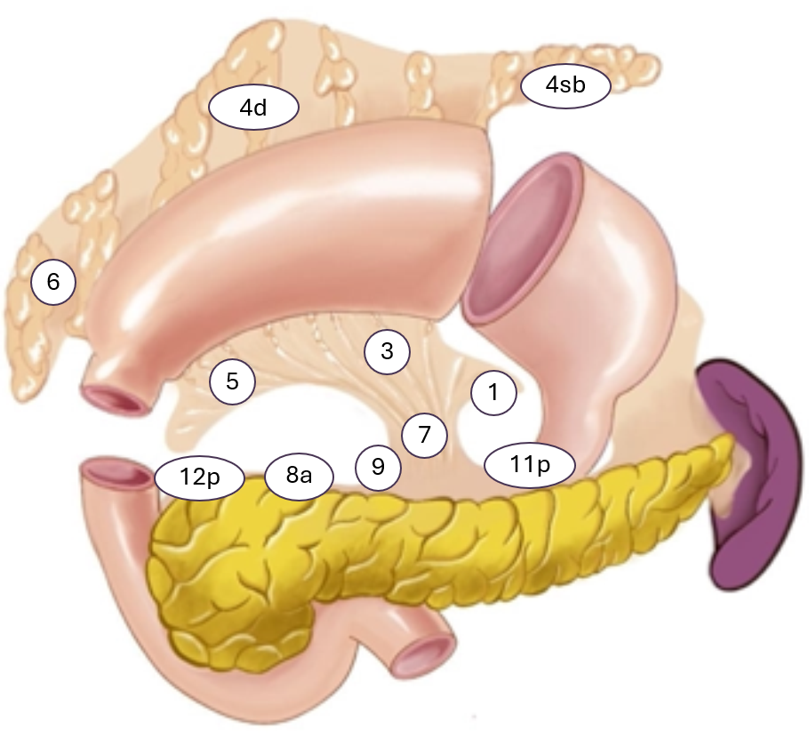 Figur 9: Hentet fra Japanese Gastric Cancer Association (2023). CC BY 4.0. Open access.